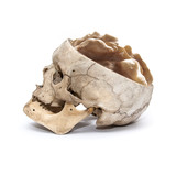Side view of human skull with walnut instead of brain