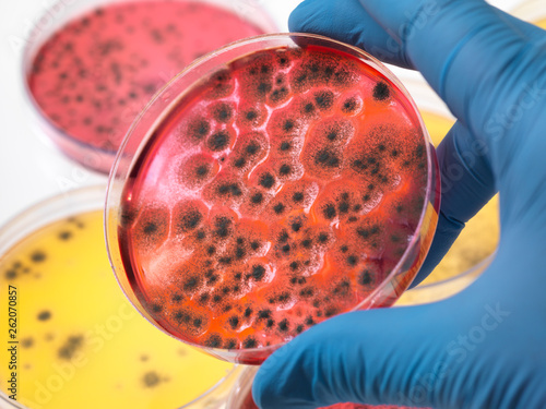 Scientist examining petri dishes containing bacterial growth in the laboratory photo