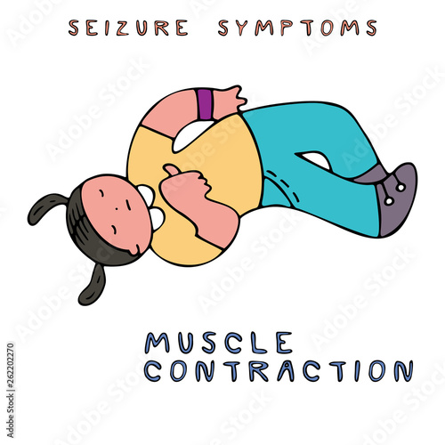 Epilepsy seizure symptoms