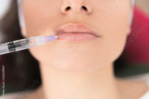 Mesotherapy treatment on female lips