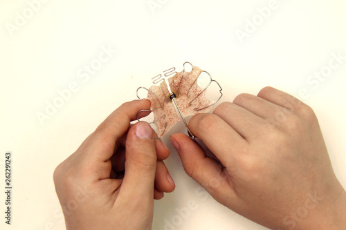 Child turns the screw to expand the anatomical orthodontic plate made of pink acrylic and metal in the shape of the jaw to preserve the bite. Close uo, top view, flatlay, copy space for text.