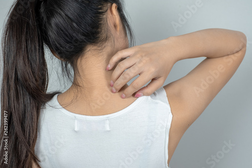 woman injury Nape of the neck pain and occipital.