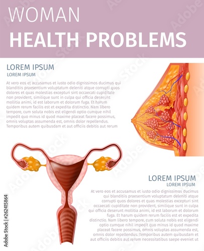 Woman Health Problem. Female Uterus and Breast