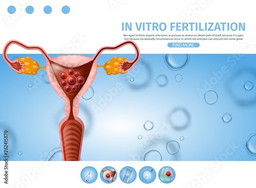 In Vitro Fertilization Informational Aid Banner.