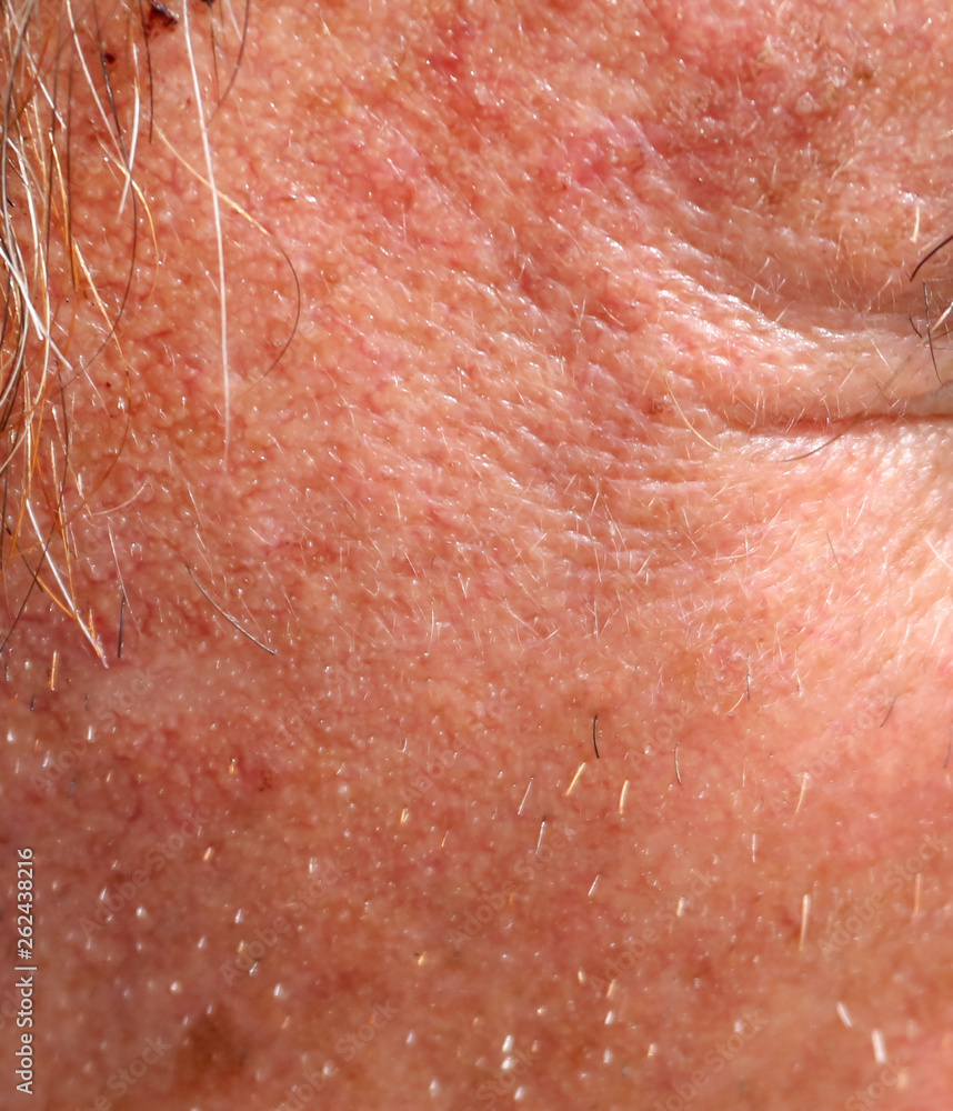 Fototapeta premium The skin of an old man as a background