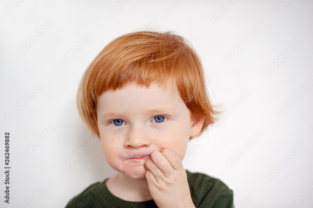 A boy with allergies on his face, itching A boy with allergies on his face, itching