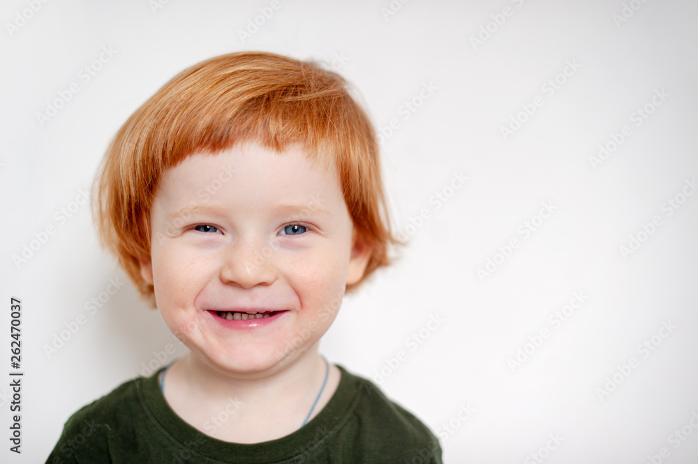 Boy with allergies on his face Boy with allergies on his face