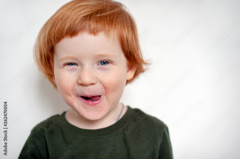 Boy with allergies on his face Boy with allergies on his face