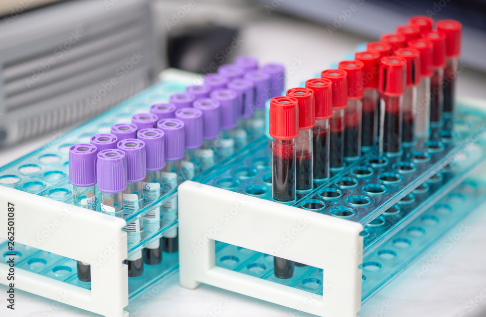 Fototapeta premium Tubes of blood sample for testing