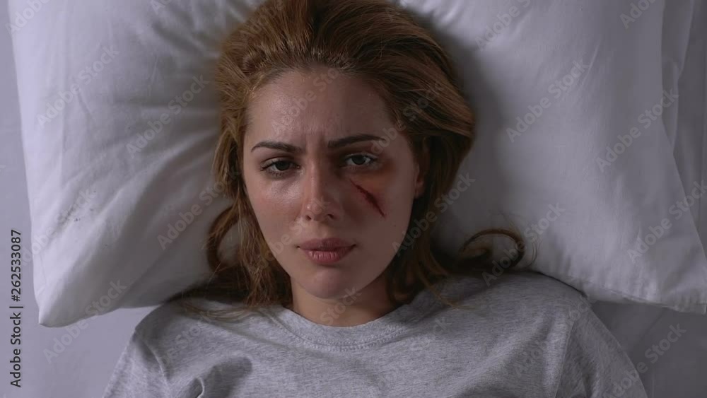 Desperate woman with wounded face lying on bed and looking at camera, victim Desperate woman with wounded face lying on bed and looking at camera, victim