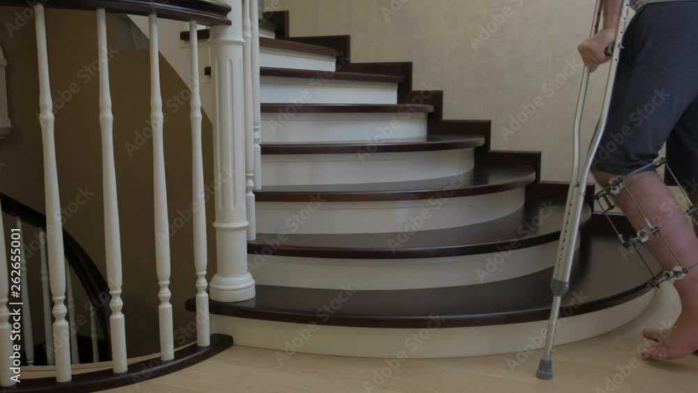 Descend the stairs on crutches with a broken leg in Ilizarov's external fixative StockVideo