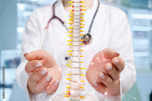 A physician with an artificial spine model in her hands.