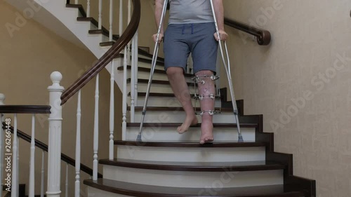 Descend the stairs on crutches with a broken leg in Ilizarov's external fixative photo