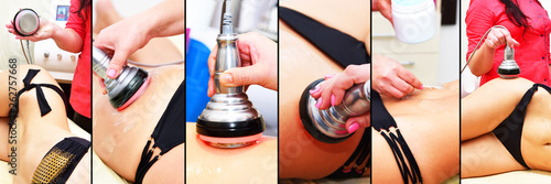 Foto Rf skin tightening, belly