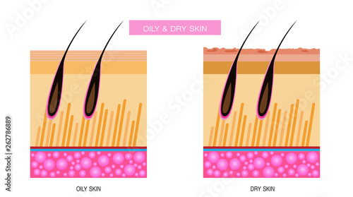 Oily & dry skin,Vector Illustration
