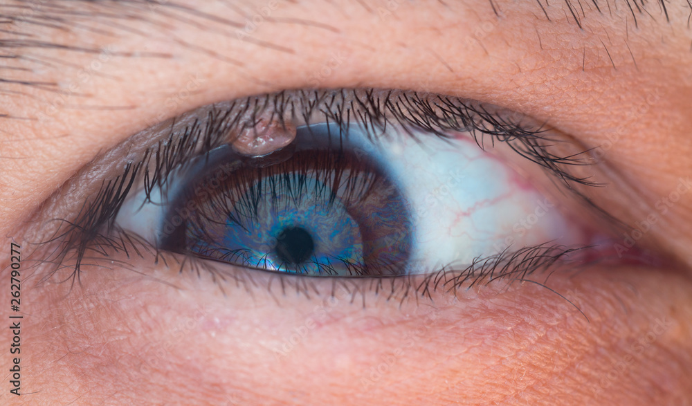 Fototapeta premium Human eye medical detail