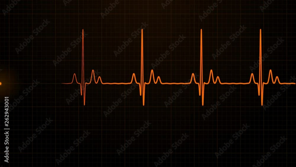 Loopable Orange EKG/ECG cardiogram oscilloscope monitor heartbeat line