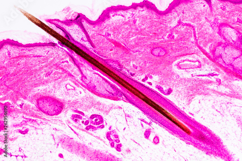 Education anatomy and physiology of Human scalp show of hair folticles under the microscopic in laboratory. photo