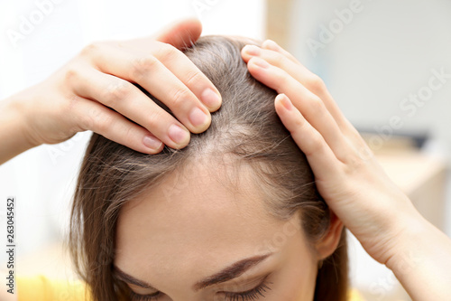 Young woman with hair loss problem indoors, closeup photo