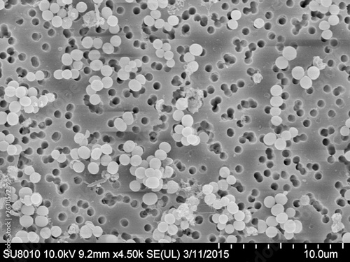 Konstfotografi Scanning Electron Microscopy of Staphylococcus aureus on a membrane filter