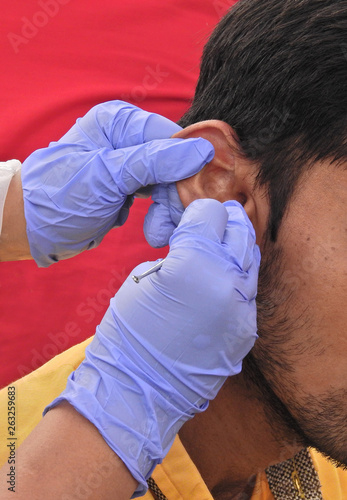 Closeup view of Doctor checking ear of the patient