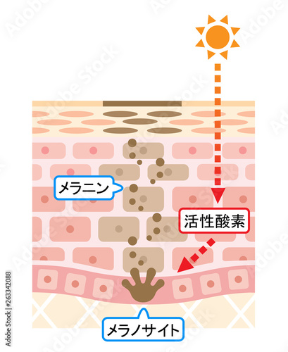 しみの構造　肌の断面図