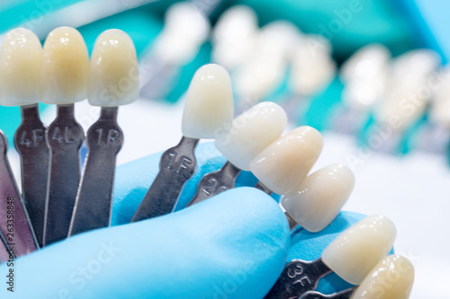 Close up shade guide for check color of tooth crown in clinic. photo