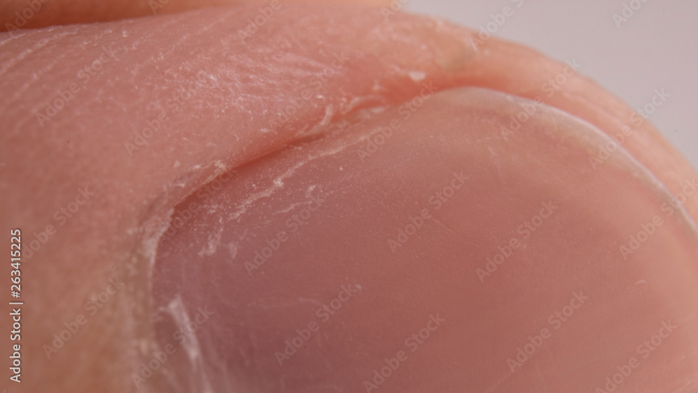 Fototapeta premium Macro photo of big finger nail. Cuticles manicure