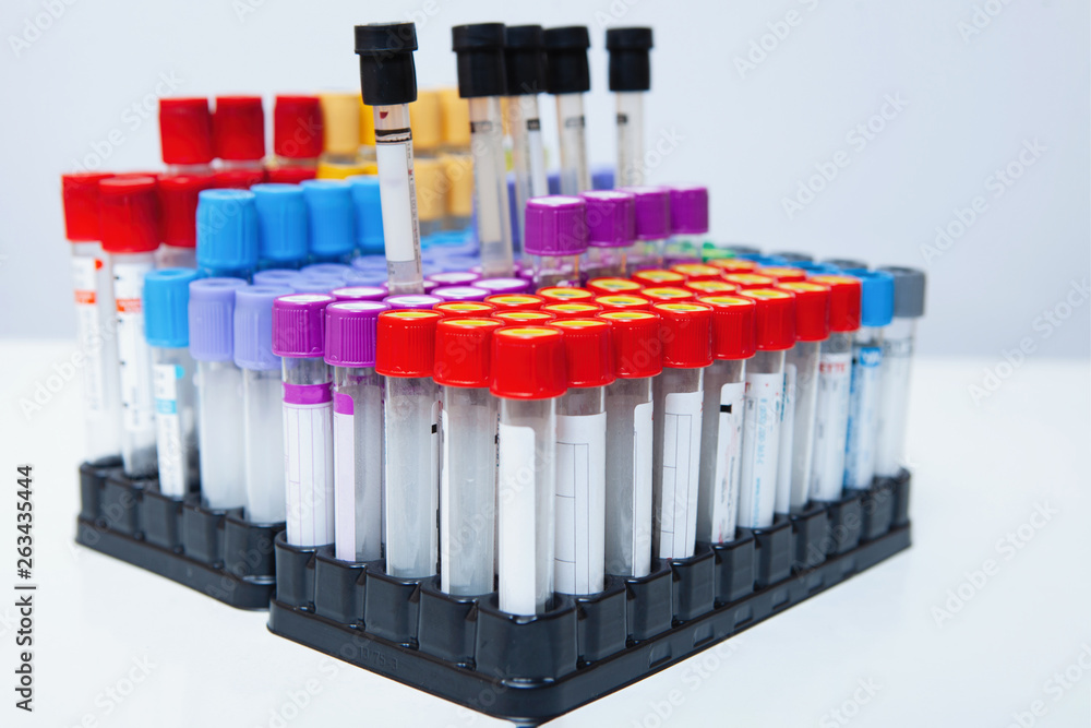 Rack with several tubes with blood. Rack with several tubes with blood.