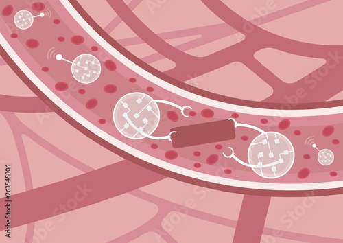 Future of medicine. Nanobots in action. Nanorobots detecting and eliminating thrombus in blood vessels