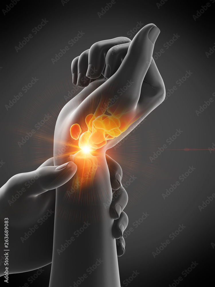 3d rendered medically accurate illustration of a mans painful wrist 3d rendered medically accurate illustration of a mans painful wrist