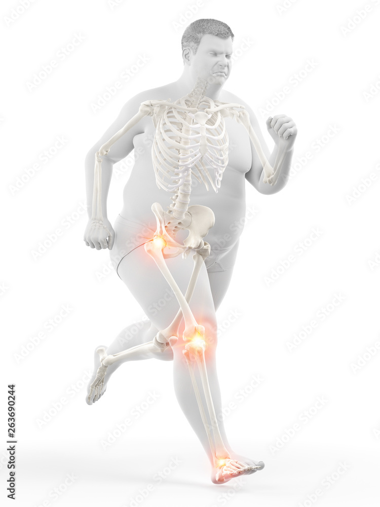 3d rendered medically accurate illustration of an obese runners painful joints 3d rendered medically accurate illustration of an obese runners painful joints