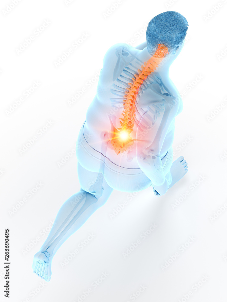 3d rendered medically accurate illustration of an obese runners painful back 3d rendered medically accurate illustration of an obese runners painful back