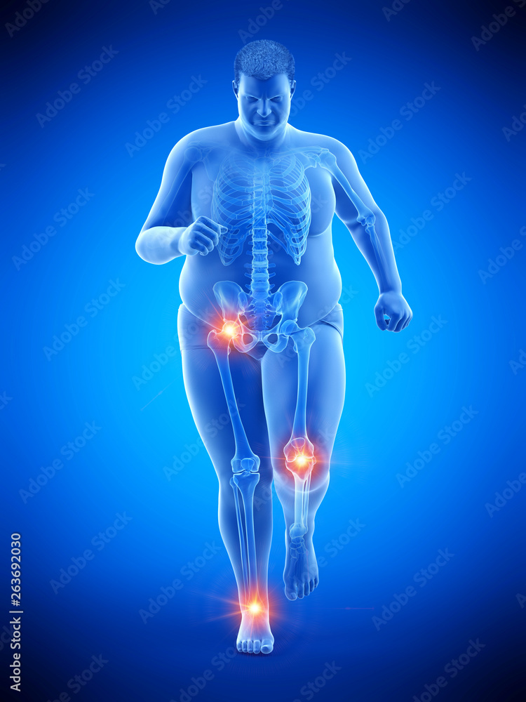 3d rendered medically accurate illustration of an obese runners painful joints 3d rendered medically accurate illustration of an obese runners painful joints
