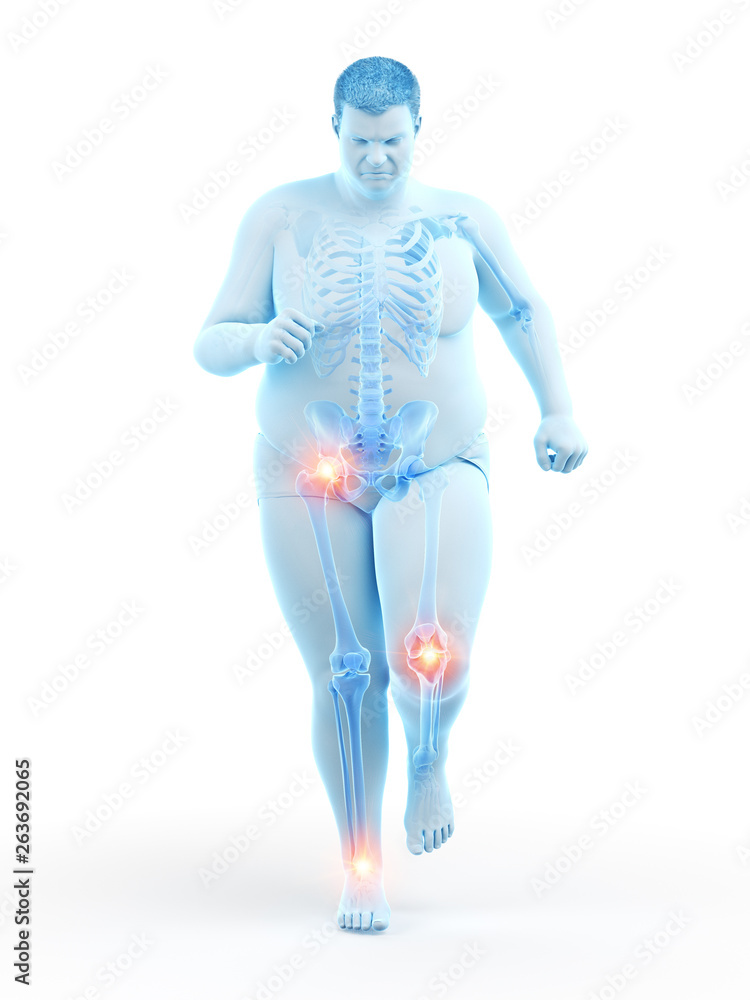 3d rendered medically accurate illustration of an obese runners painful joints 3d rendered medically accurate illustration of an obese runners painful joints