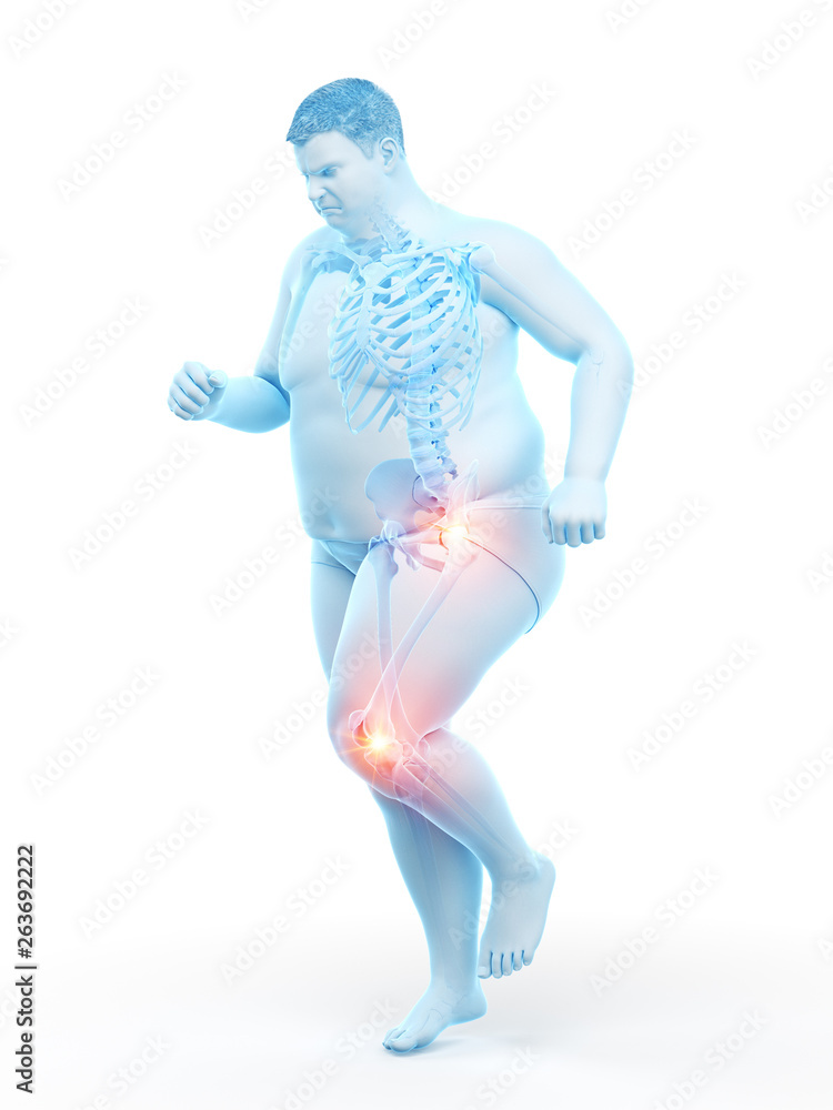 3d rendered medically accurate illustration of an obese runners painful joints 3d rendered medically accurate illustration of an obese runners painful joints