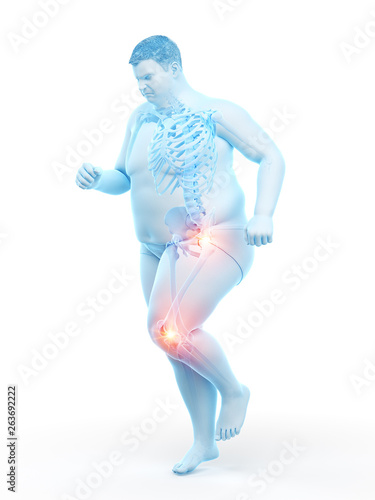 3d rendered medically accurate illustration of an obese runners painful joints