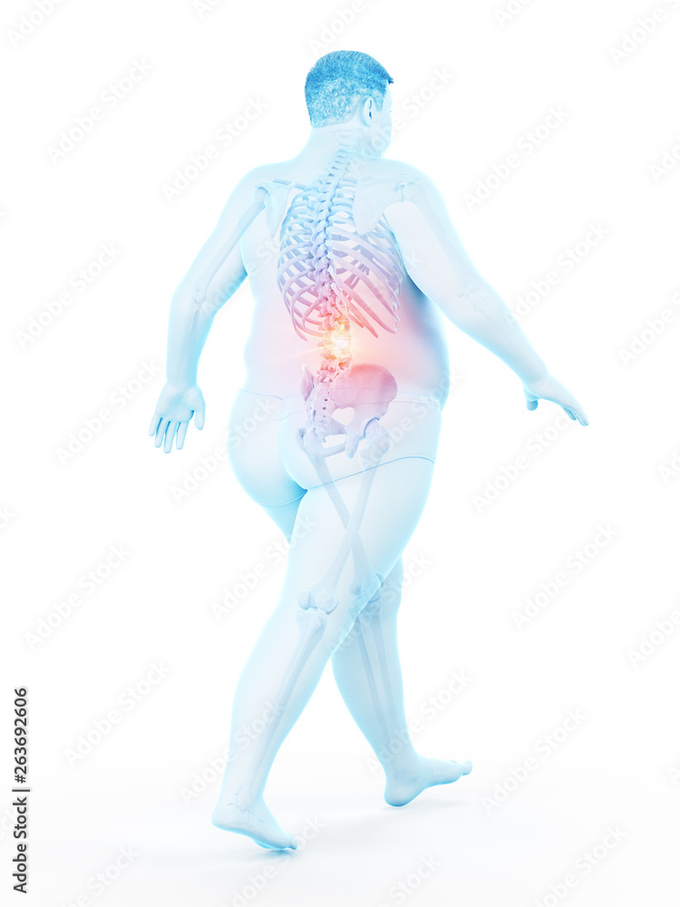 3d rendered medically accurate illustration of an obese runners painful back