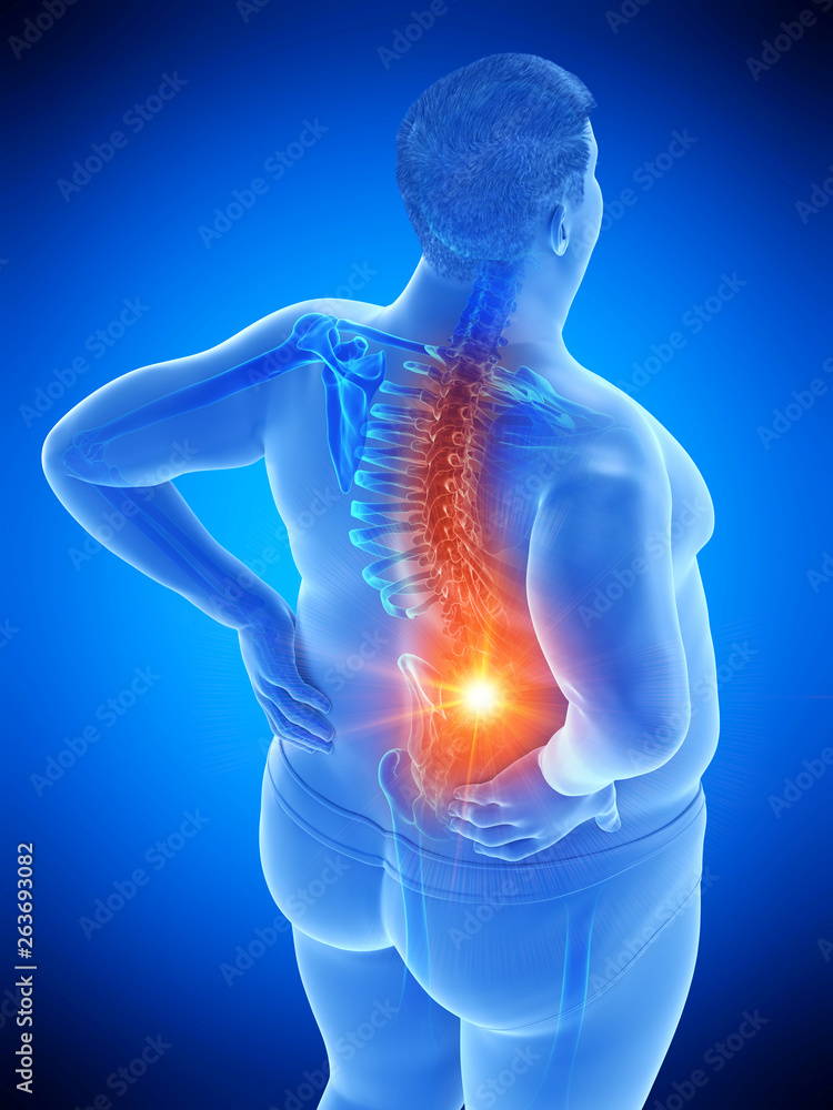 3d rendered medically accurate illustration of an obese mans painful back 3d rendered medically accurate illustration of an obese mans painful back