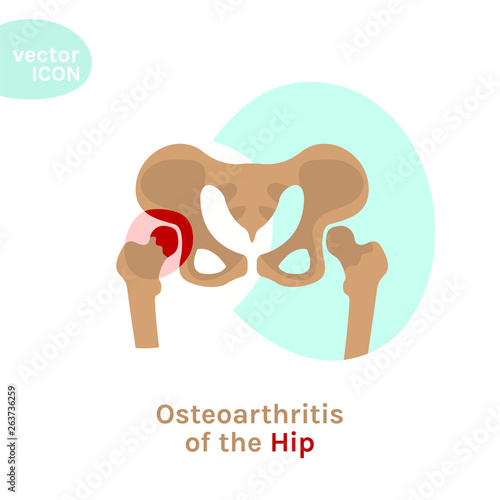 Hip osteoarthritis icon