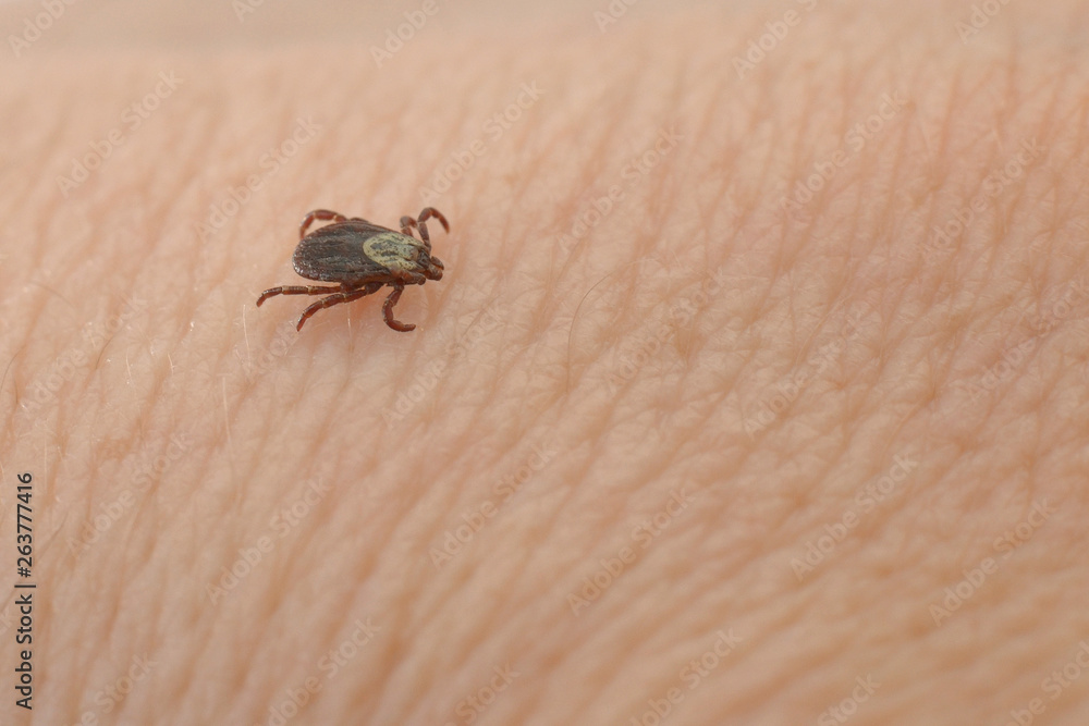 Obraz premium insect parasite blood-sucking mite on human skin