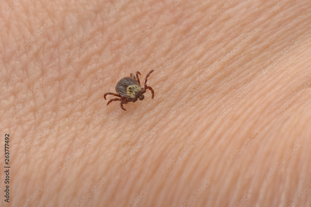 Tick is crawling on human body skin