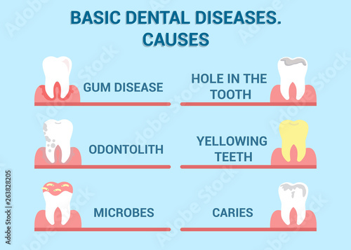 Dental Diseases, Cavity Illness Vector Info Poster