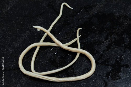 Ascariasis is a disease caused by the parasitic roundworm Ascaris lumbricoides for education in laboratories.