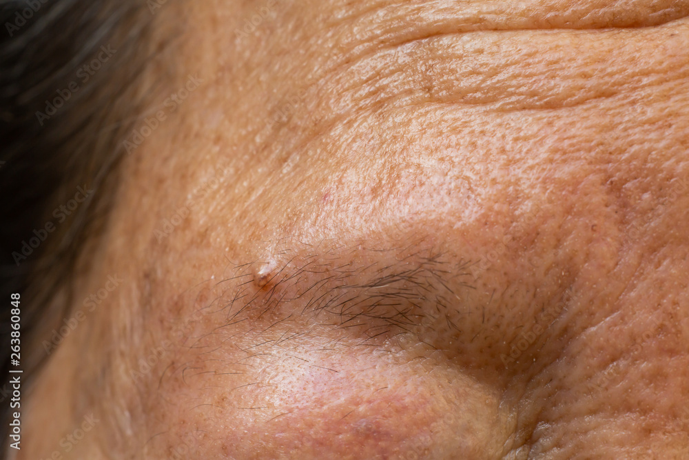 Fototapeta premium Senior woman's thin eyebrows, Wrinkled forehead, Brown mole, Close up & Macro shot, Selective focus, Body part, Healthcare concept