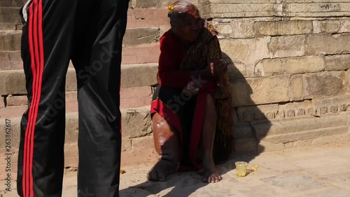 Old lady with elephantiasis begging on the grounds of Taumadhi Square in Bhaktapur Nepal. photo