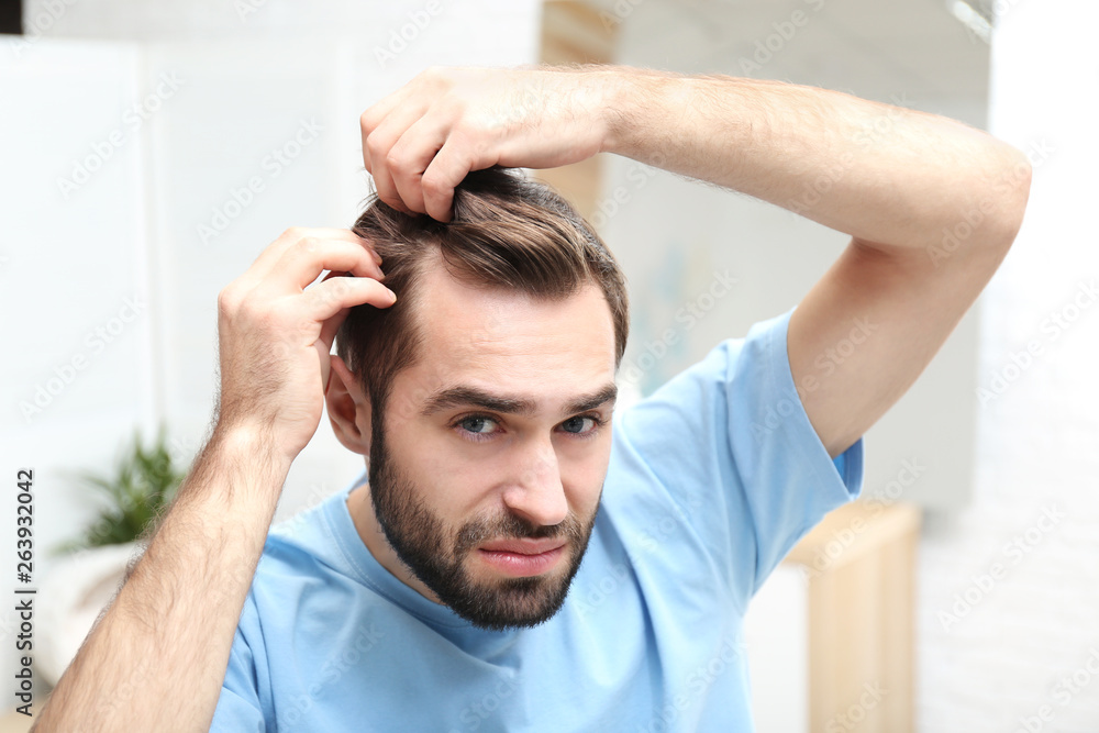 Young man with hair loss problem indoors Young man with hair loss problem indoors