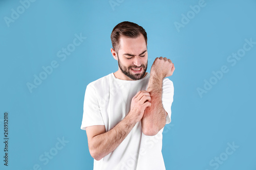 Young man scratching hand on color background. Allergies symptoms