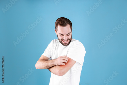 Young man scratching hand on color background. Allergies symptoms