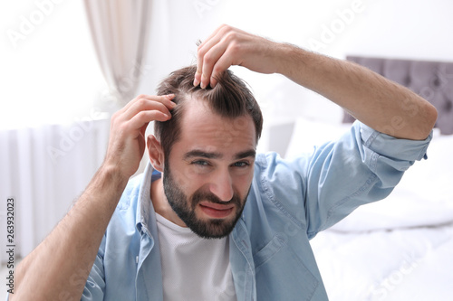 Young man with hair loss problem indoors